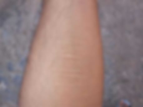 Kendine Zarar Verme Davranışı